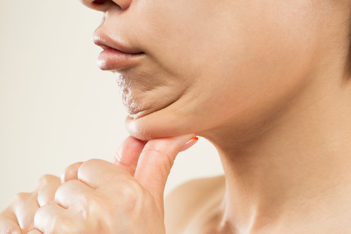 Haltbarkeit Fettabsaugung Kinn Haltbarkeit Fettabsaugung Kinn